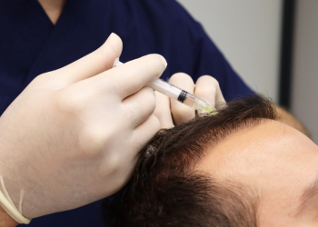 Queda de Cabelo