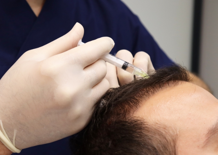 Queda de Cabelo No Instituto Shalon identificamos as causas da queda de cabelos e alopecia, oferecendo tratamentos personalizados para restaurar a saúde capilar. Fale conosco e saiba mais!