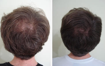 antes3